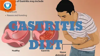 Gastritis Diet | What to Eat and What to Avoid