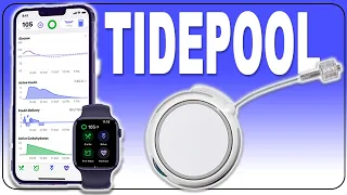 New Pump Uses Tidepool Loop - How it Works
