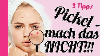 🆘️Pickel schnell loswerden?! Mach das auf KEINEN Fall! (3 Tipps für starke Mädchen)