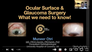 Glaucoma - Taming The Monster - Ocular Surface and Glaucoma Surgery - Muneer Otri