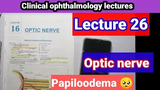 🔴 optic neuritis. Lecture #26 clinical ophthalmology. papillitus. papiloodema.