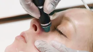 HydraFacial (Pore Vacuum) 6 Step Treatment in 1