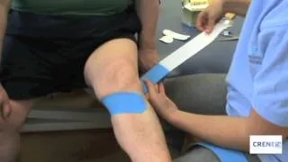 Corrección de la hiperextensión de rodilla con vendaje neuromuscular. Concepto Bobath