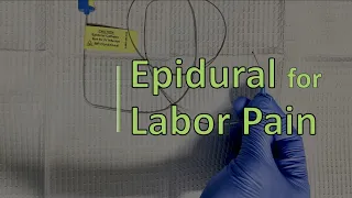 Delivering a Baby: Epidural Anesthesia for Labor Pain