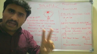 DIPLOPIA