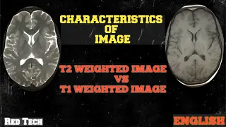 MRI || T2 vs T1 WEIGHTED IMAGE || ENGLISH ||