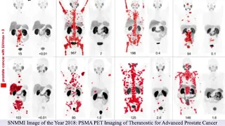 Theranostics: Successfully Combining Diagnostics and Cancer Treatment - The Science of Healing CLIP