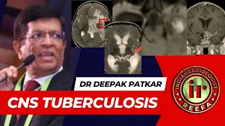 CNS TUBERCULOSIS | DR DEEPAK PATKAR || TB meningitis | Tuberculoma | Cysticercosis | T2Hypo