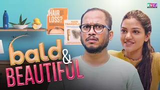 Bald & Beautiful | Ft. Tushar Khair & Mugdha Agarwal | RVCJ