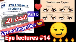 Eye lectures #14 . #Strabismus. #Squient. exotropia entropia #hypertropia #hypotropia #eye hirshburg