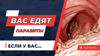 Как узнать что в теле паразиты и противопаразитарная СУПЕР ЕДА! #здоровьедолголетие