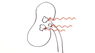 Ultrasound | GCSE Physics | Doodle Science