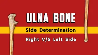 Ulna Bone- 2, Side determination | Right or Left side | TCML