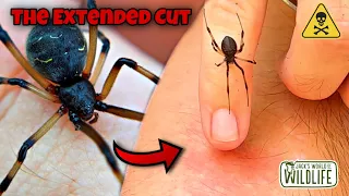 BROWN WIDOW BITE! ARE They DANGEROUS?? The EXTENDED CUT!