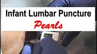 Infant Lumbar Puncture Pearls