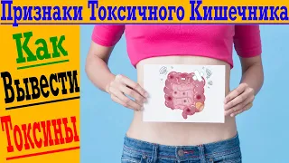 Признаки ТОКСИЧНОГО Кишечника! Как вывести ТОКСИНЫ?!