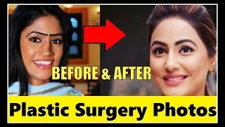 Plastic Surgery Photos Of Popular TV Actresses - BEFORE & AFTER (2018) | You don't knows | 2018