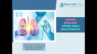 Stem Cell Therapy For Lungs Disease | Best Stem Cell Hospital In Delhi | Treatment For Lung Disease