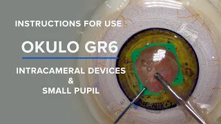 BIONIKO - OKULO GR6 for Advanced Intracameral Devices