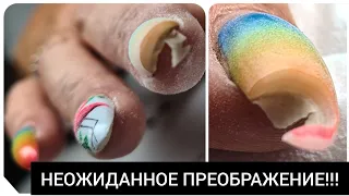 УБЕРИ это НЕМЕДЛЕННО ///  AGENT nail