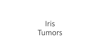 Iris Tumors - For Ophthalmology Residents