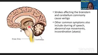 Spinning Around - An SGH Webinar on Dizziness