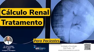 Cirurgia para tratamento de pedra no rim. O que todo paciente precisa saber