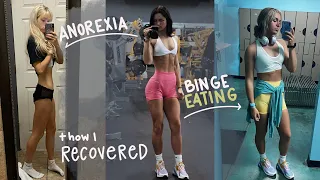 my 5 YEAR eating disorder story | anorexia and binge eating recovery journey