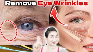 3 Essential Orbicularis Oculi Massages and Exercises to Remove Wrinkles Around the Eyes in 14 Days