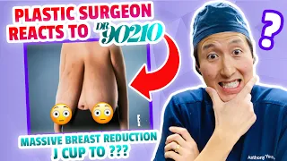 Plastic Surgeon Reacts to The LARGEST Breast Reduction on an Instagram MODEL!