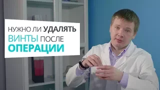 Нужно ли удалять винты после операции по удалению косточки доктор Алексей Олейник #footclinic