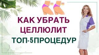 💊 КАК УБРАТЬ ЦЕЛЛЮЛИТ❓КАК ПОХУДЕТЬ? ПИТАНИЕ И ПРОЦЕДУРЫ Врач эндокринолог, диетолог Ольга Павлова