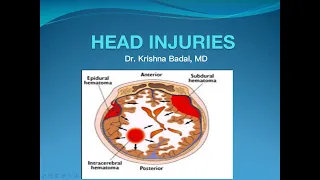 Head Injury