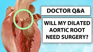 Doctor Q&A: The Progression and Surgery of Dilated Aortic Root Aneurysms with Dr. Luis Castro