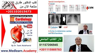 Heart Failure  #cme #internal_medicine #ecg #usmle #medical #محاضرات_باطنة