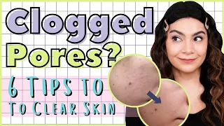 Congested Skin | 6 Habits that Help me Keep My Pores Clear