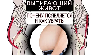 Выпирающий живот. Почему появляется и как убрать.