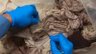 Nerves and Arteries of the Pelvis (take 2)