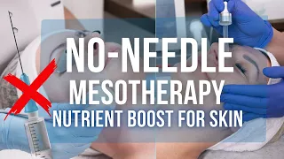 NO-NEEDLE MESOTHERAPY💉❌️ - who is it for, benefits, effects & a professional treatment👌