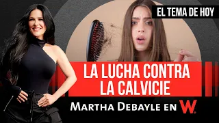 Martha Debayle - Tema: Una LUCHA contra la CAÍDA de CABELLO | W Radio