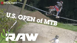 Vital RAW - U.S. Open of Mountain Biking