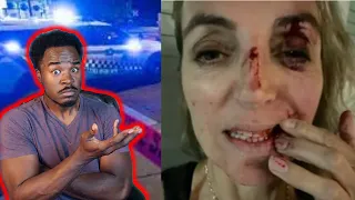 Portland Doctor blames '' defund the police'' for slow response from being attacked by homeless man!
