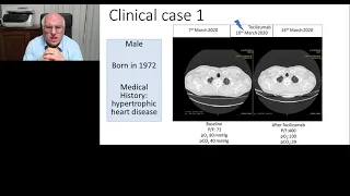 How COVID-19 has changed an immuno-oncologist’s life