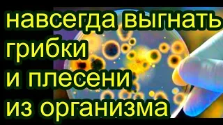 избавиться от грибов и плесени  в теле, В чем причина ПСОРИАЗА ? #здоровье