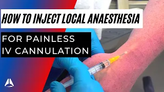 How to Inject Local Anaesthetic before IV cannulation