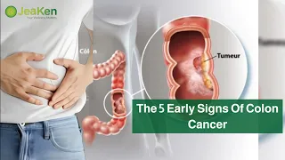 The 5 Early Signs Of Colon Cancer
