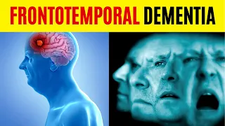 Frontotemporal Dementia | The Terrible Reality of Frontotemporal Dementia