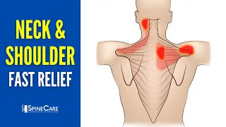 How to INSTANTLY Relieve Neck and Shoulder Pain