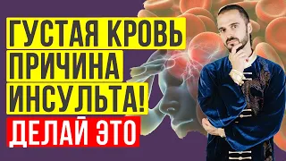 Как разжижать густую кровь без лекарств! #Shorts