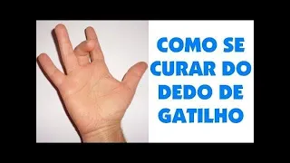 DEDO em GATILHO TENOSSINOVITE ESTENOSANTE CAUSAS & TRATAMENTO Clínica Fisioterapia Dr. Robson Sitta